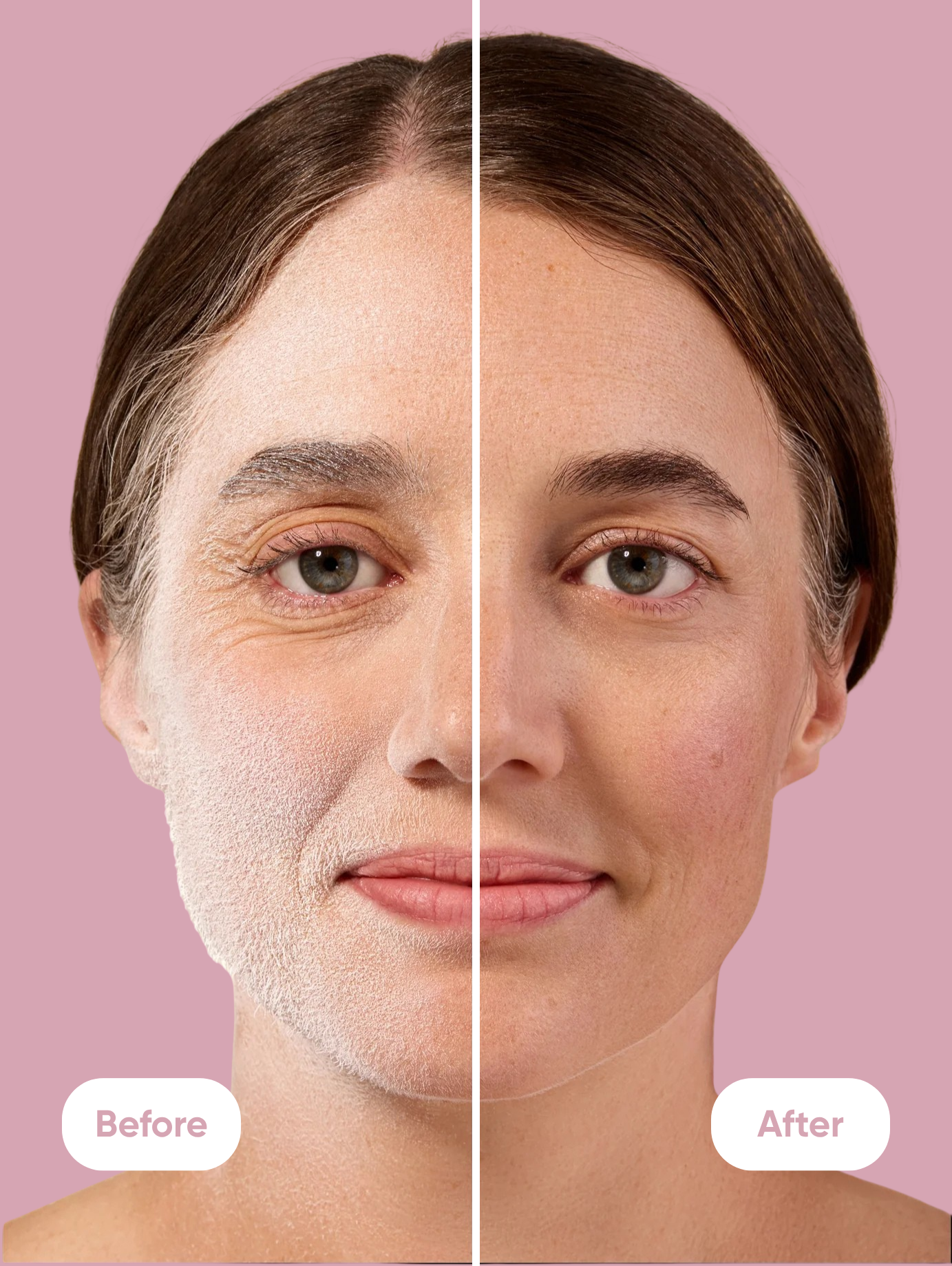 SoftSmooth Duo™